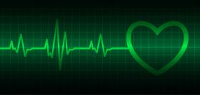 ekg